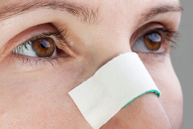 Possible complications in the postoperative period of nasal septum correction